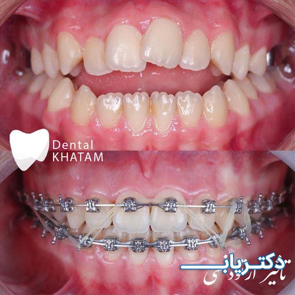 نمونه کار کلینیک دندانپزشکی خاتم 2
