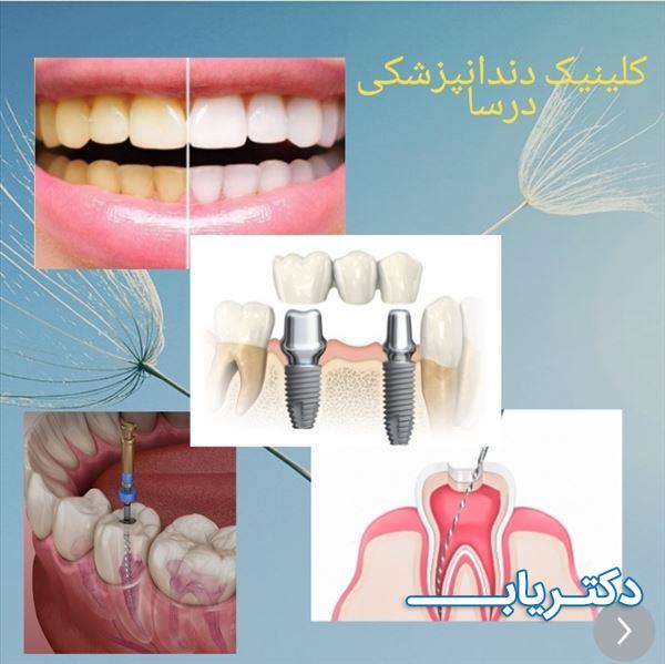 نمونه کار کلینیک دندانپزشکی درسا 2