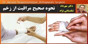 نحوه صحیح مراقبت از زخم نحوه صحیح مراقبت از زخم