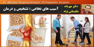 آسیب نخاعی آسیب نخاعی