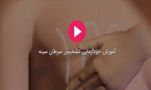 آموزش خودآزمایی سرطان پستان در زنان+فیلم آموزش خودآزمایی سرطان پستان در زنان+فیلم