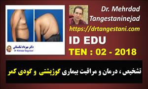 تشخیص ، درمان و مراقبت از گوژپشتی و گودی کمر