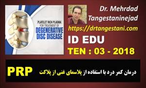 درمان کمر درد با استفاده از پلاسمای غنی از پلاکت درمان کمر درد با استفاده از پلاسمای غنی از پلاکت