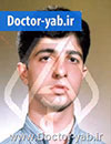 دکتر رضا ابراهیمی راد
