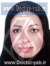 دکتر زهرا کاشه گردبیشه