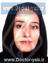دکتر عطیه زحمت کش