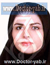 دکتر مروارید حاج منوچهری