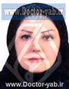 لیلا نوذری