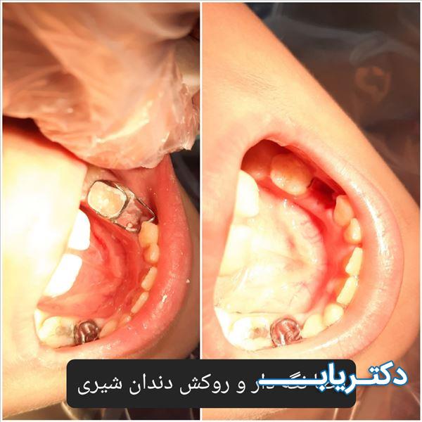 نمونه کار دکتر زکیه فروزان نژاد 2