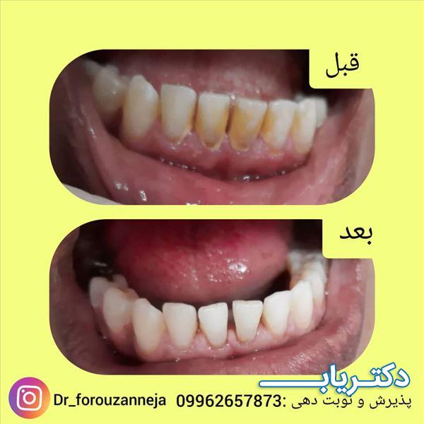 نمونه کار دکتر زکیه فروزان نژاد 3