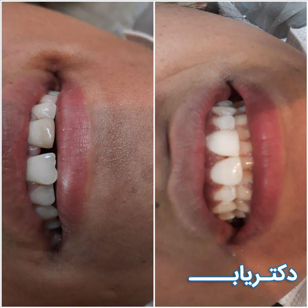نمونه کار دکتر زکیه فروزان نژاد 5