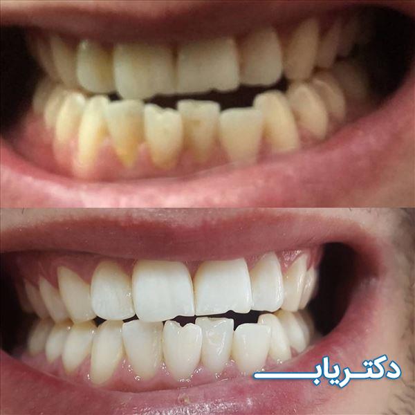 نمونه کار دکتر سعیده اسلامی خاور