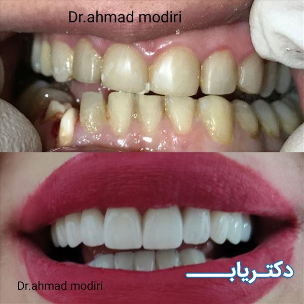 نمونه کار دکتر احمد مدیری