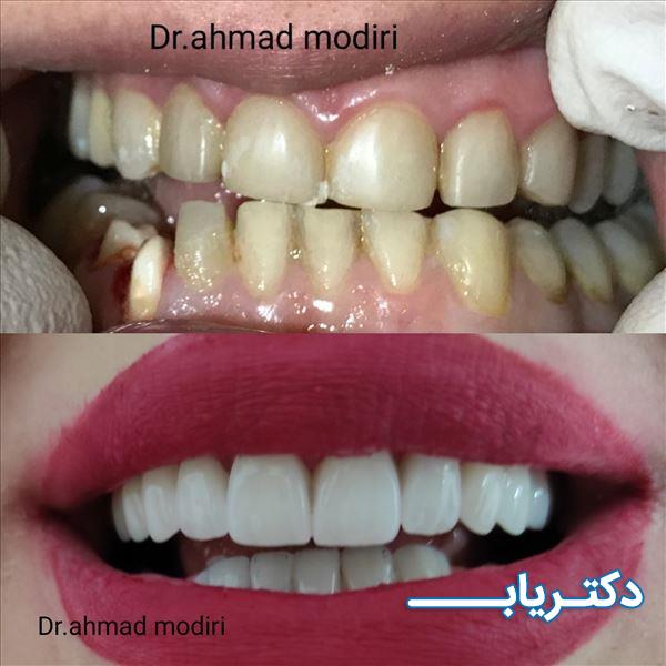 نمونه کار دکتر احمد مدیری 1