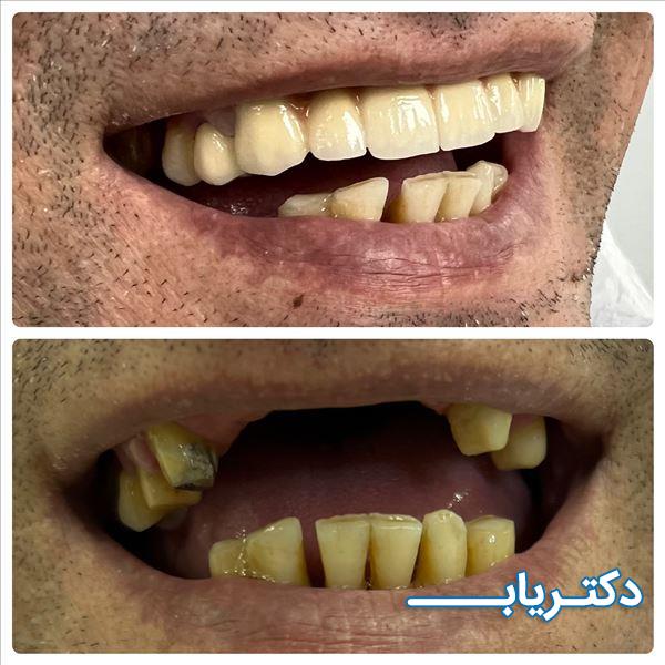 نمونه کار دکتر علی یارمحمدی 2