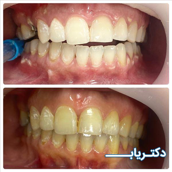 نمونه کار دکتر علی یارمحمدی 5
