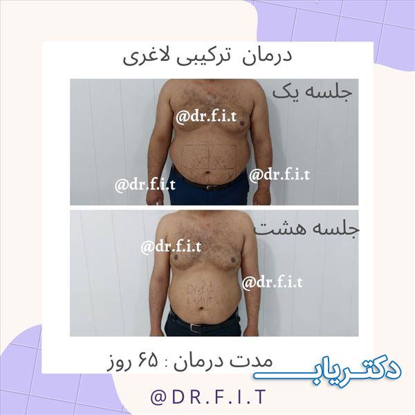 نمونه کار آزاده فرضی