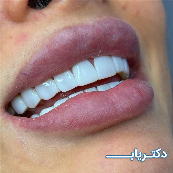 نمونه کار دکتر آزاده تقوی کاشانی