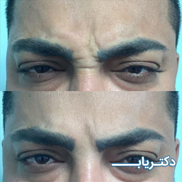 نمونه کار دکتر اعظم سلیمانی