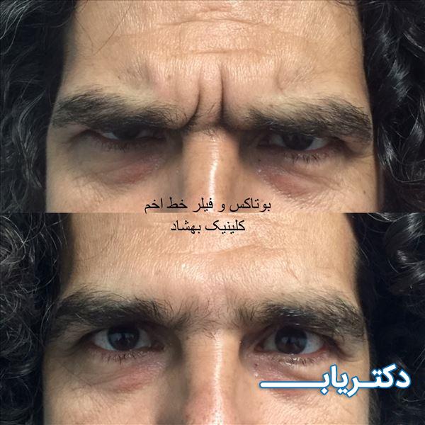 نمونه کار دکتر اعظم سلیمانی