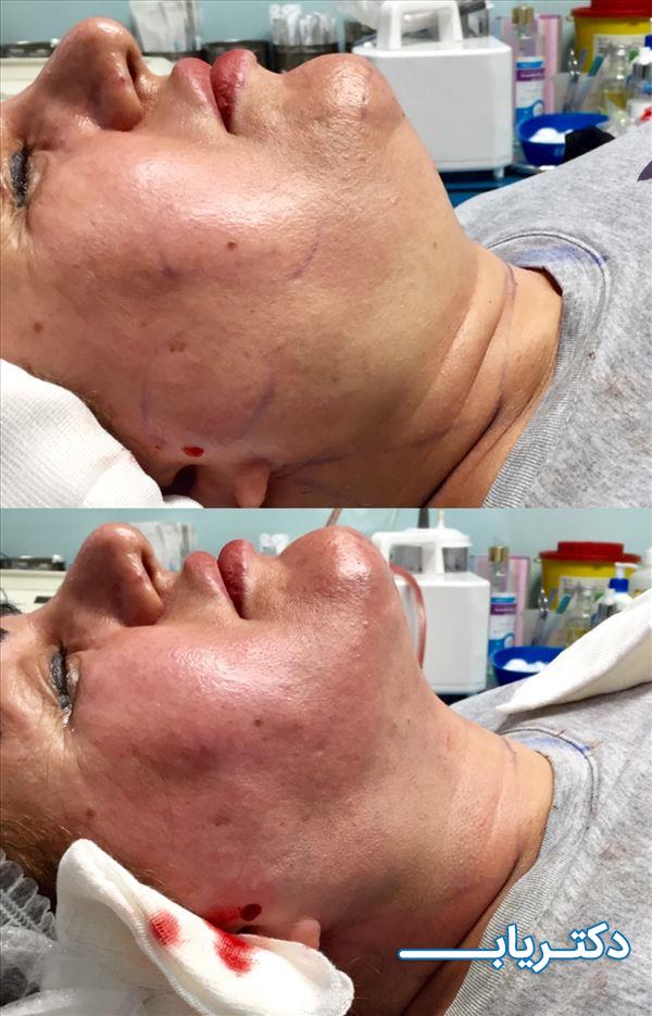 نمونه کار دکتر اعظم سلیمانی