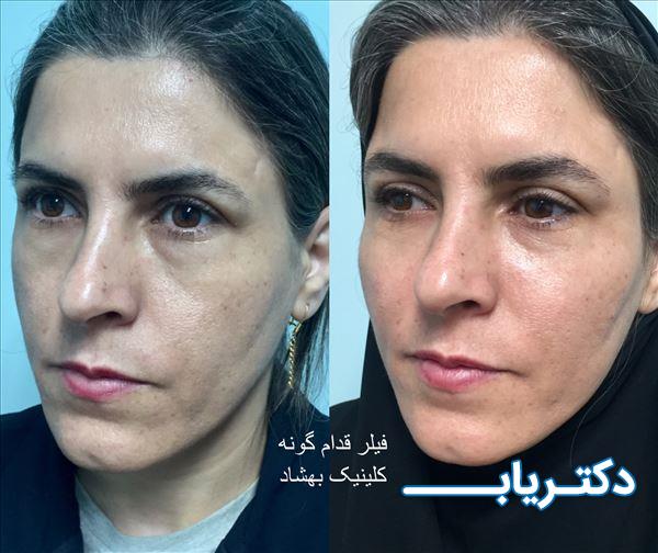 نمونه کار دکتر اعظم سلیمانی