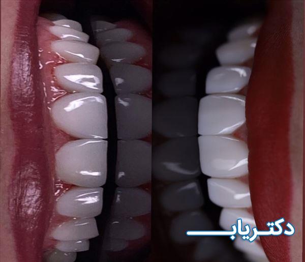 نمونه کار دکتر بشرا شاهدی 1