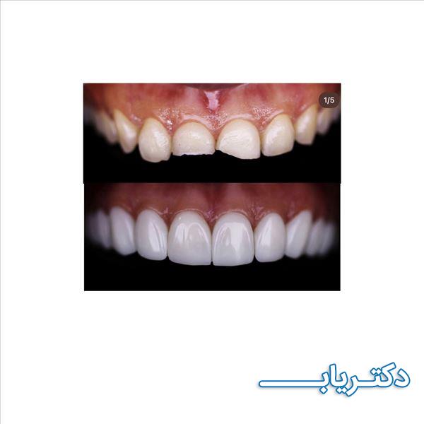 نمونه کار دکتر بشرا شاهدی 2