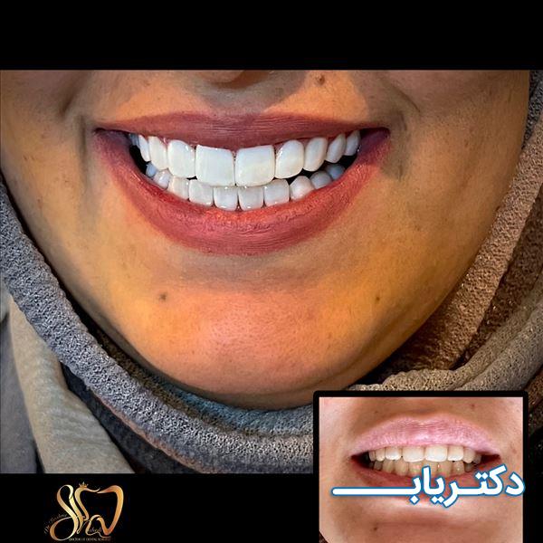 نمونه کار دکتر بشرا شاهدی 4