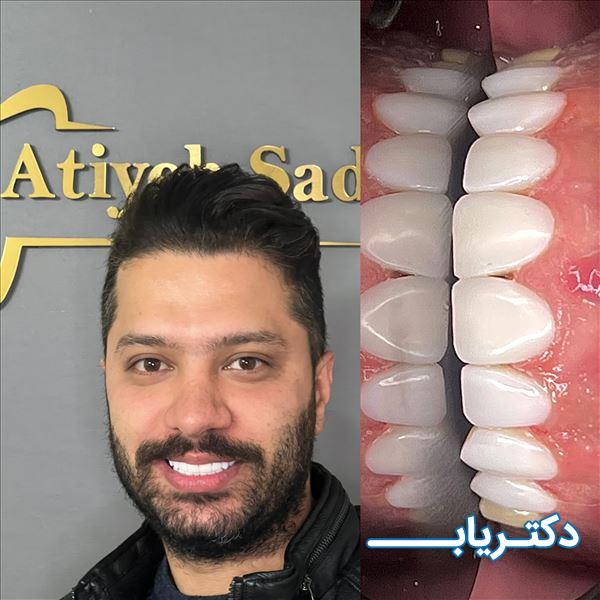 نمونه کار دکتر عطیه صادقلو