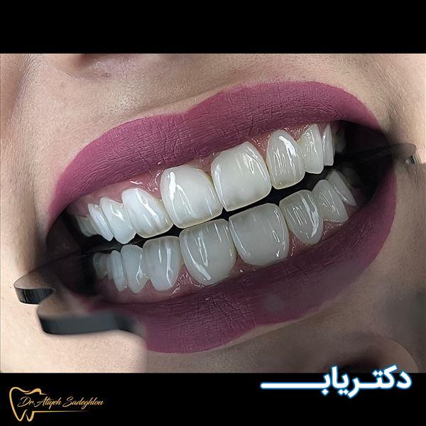 نمونه کار دکتر عطیه صادقلو
