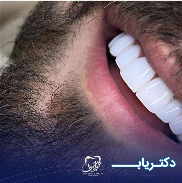 نمونه کار دکتر احسان ظهرابی