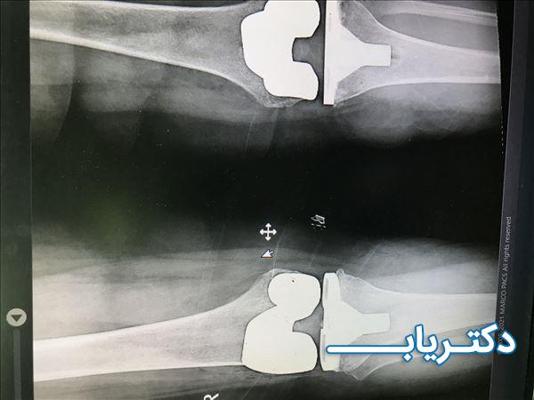 نمونه کار دکتر حمید قاضی 5