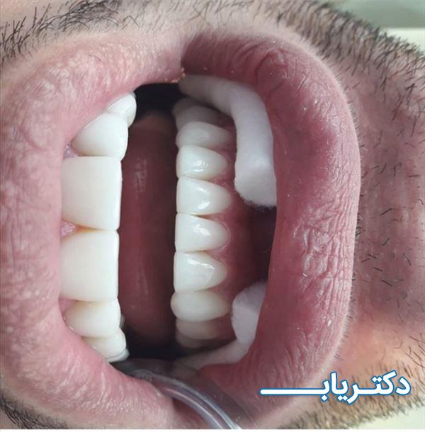 نمونه کار دکتر میثم ابراهیمی 1