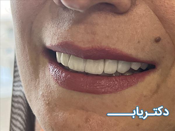 نمونه کار دکتر پریسا پرکار 5
