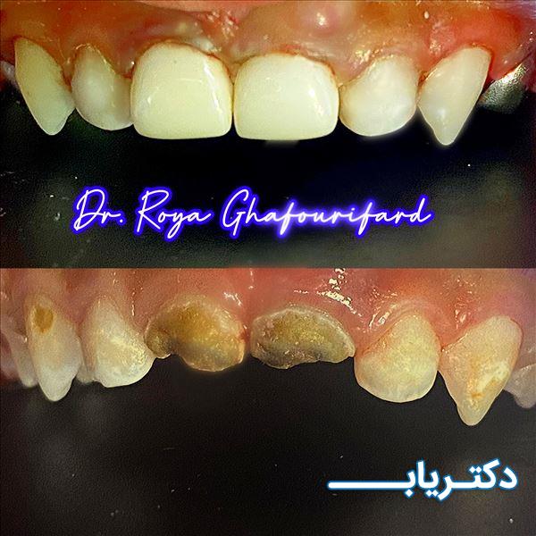 نمونه کار دکتر رویا غفوری فرد 1