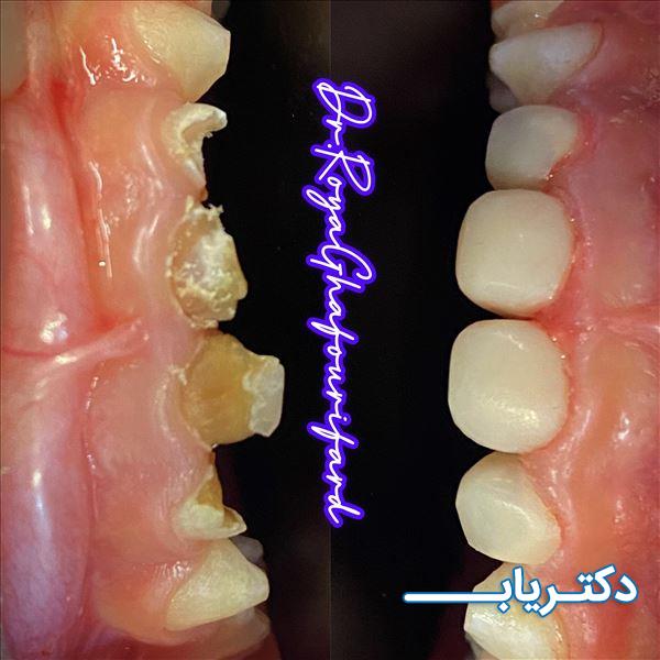 نمونه کار دکتر رویا غفوری فرد 3