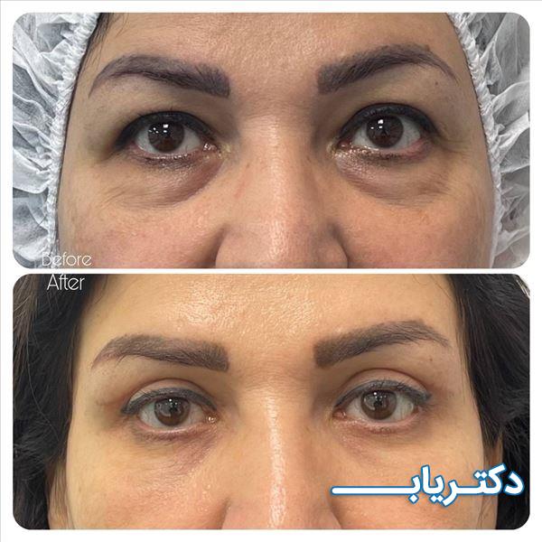 نمونه کار دکتر افسانه صادق زاده بازرگان