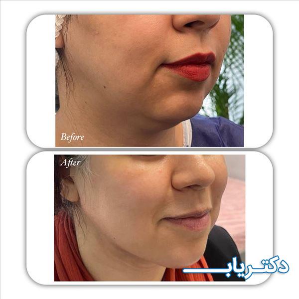 نمونه کار دکتر افسانه صادق زاده بازرگان