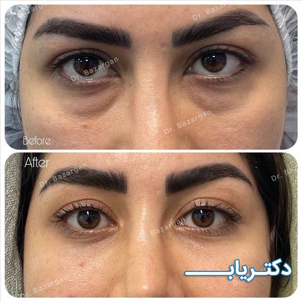 نمونه کار دکتر افسانه صادق زاده بازرگان