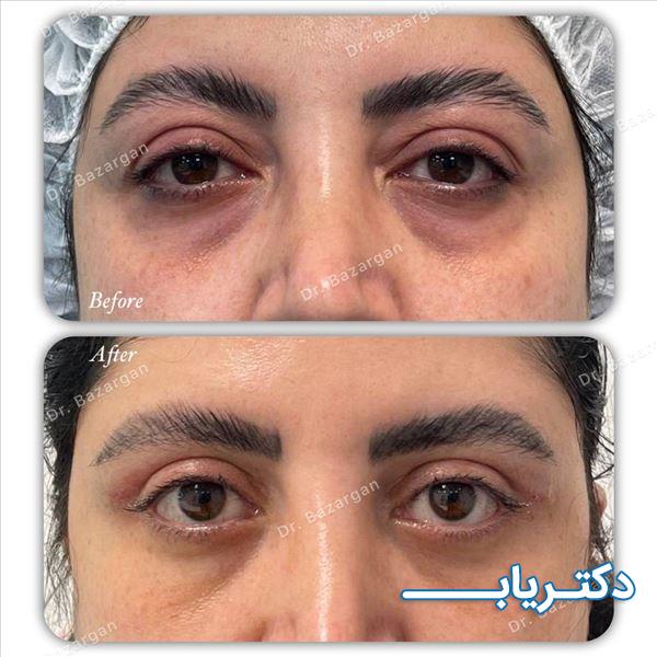 نمونه کار دکتر افسانه صادق زاده بازرگان