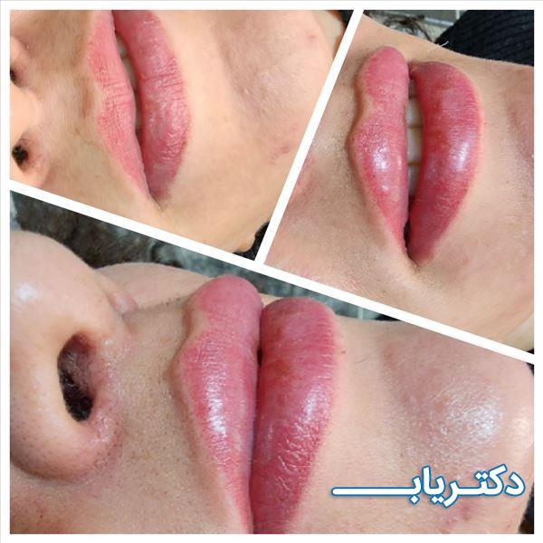 نمونه کار دکتر زهرا مشکانی