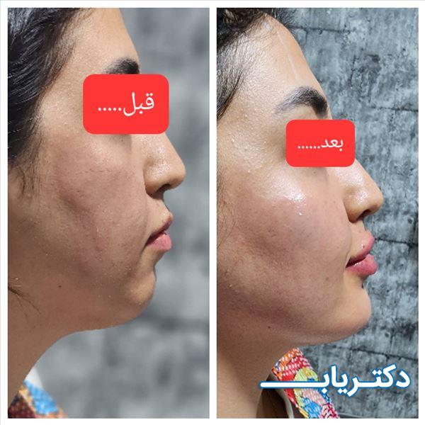 نمونه کار دکتر زهرا مشکانی