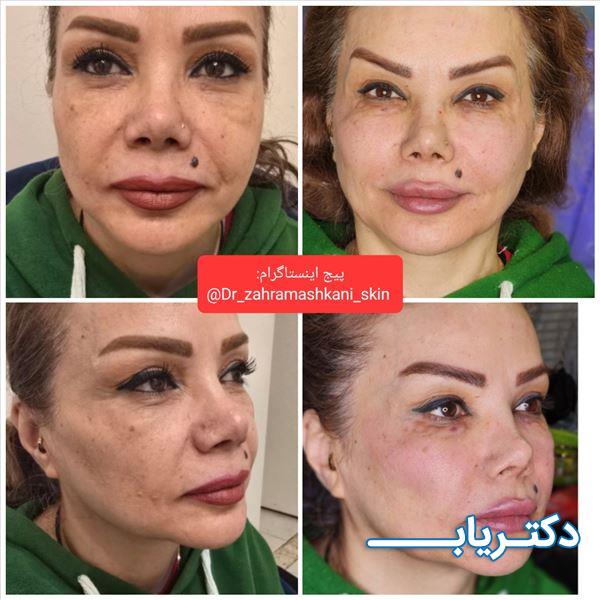 نمونه کار دکتر زهرا مشکانی