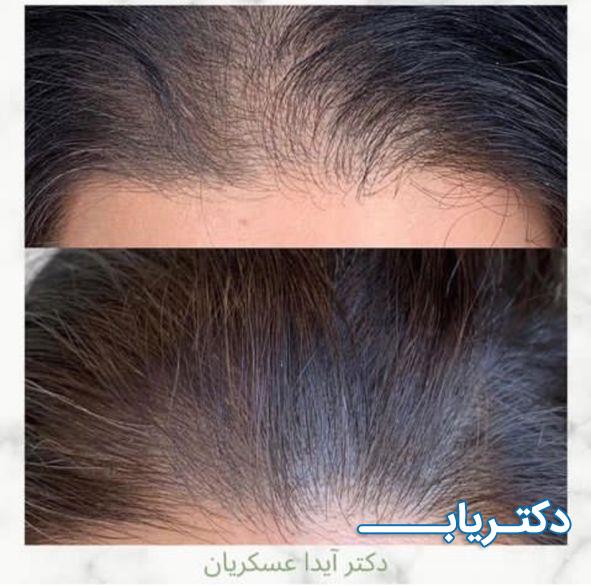 نمونه کار دکتر آیدا عسگریان 4
