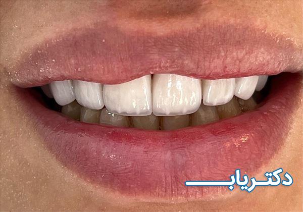 نمونه کار دکتر بابک ختایی 2
