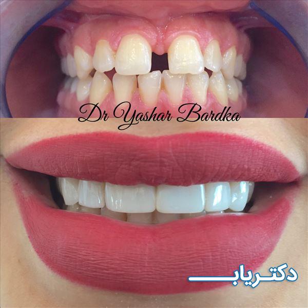 نمونه کار دکتر یاشار بردکا 1