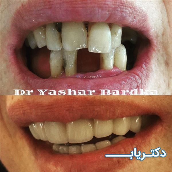 نمونه کار دکتر یاشار بردکا 2