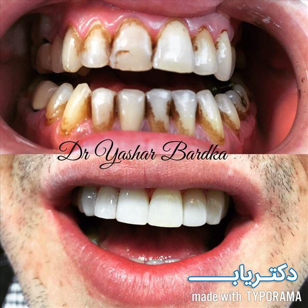نمونه کار دکتر یاشار بردکا 5