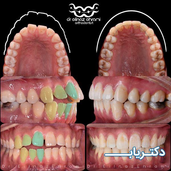 نمونه کار دکتر ایل ناز احرامی 3